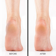 Load image into Gallery viewer, Callus Softener and File by FootLogix with FREE Foot Mousse
