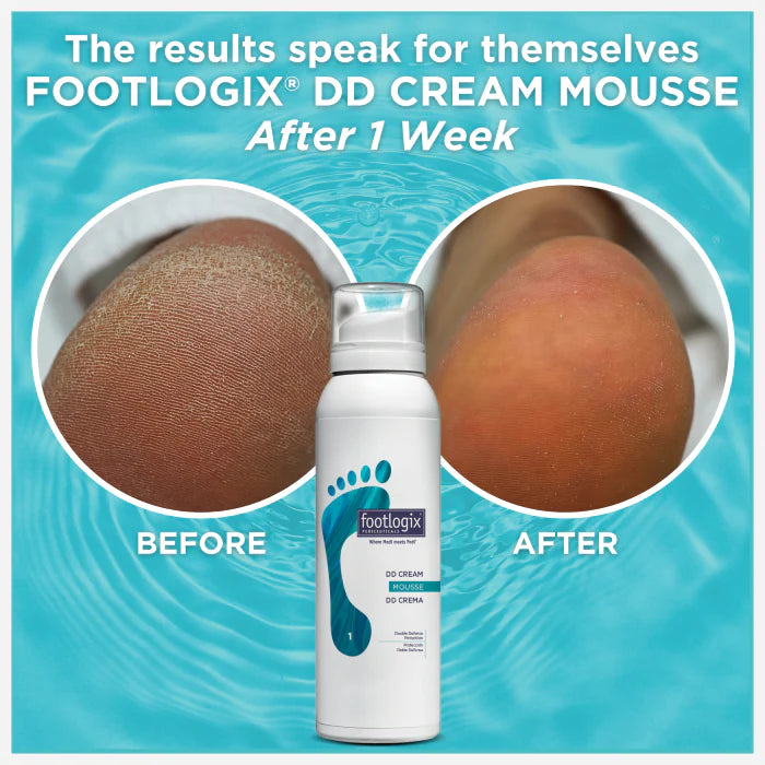 Foot Logix - Double Defense Cream Mousse