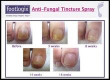 Load image into Gallery viewer, Nail Tincture Spray by FootLogix
