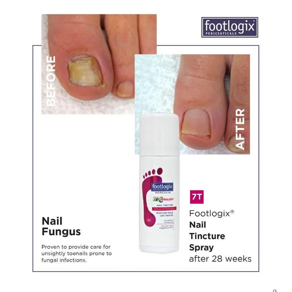 Foot Logix - Nail Tincture Spray