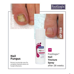 Nail Tincture Spray by FootLogix